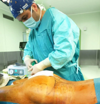 Пластический хирург Карен Пайтян проводит липофилинг