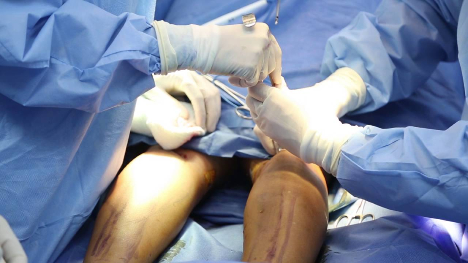 Как проводится операция по коррекции голеней