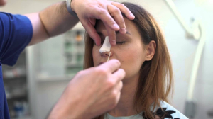 Снятие гипса после ринопластики