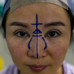 Китайские хирурги забыли вату в носу пациентки