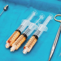 Липофилинг как малоинвазивное теломоделирование