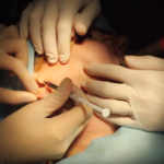 Омоложение шеи