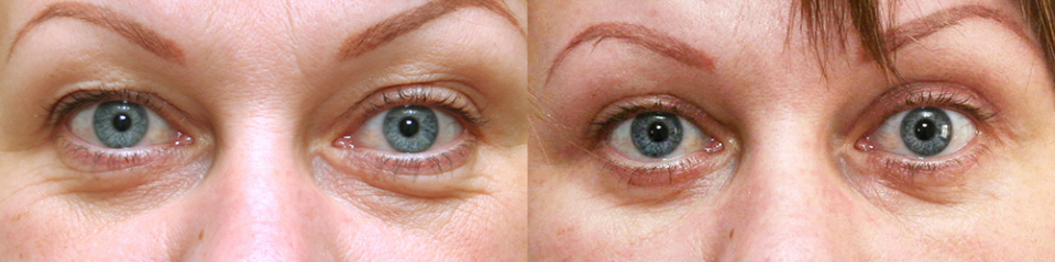 Александр Жуков блефаропластика