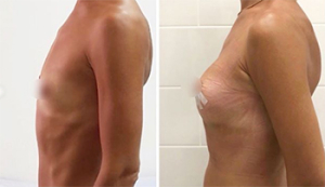 Рустем Каримов грудь