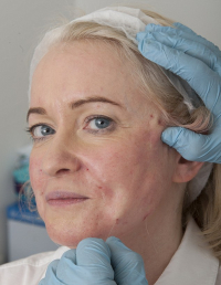 Пластические операции для пожилых людей