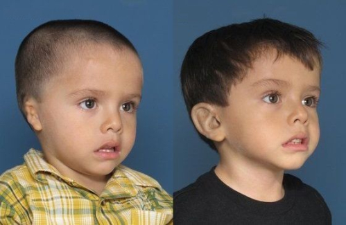 Пластические операции для детей