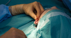 Пластическая операция на ушах