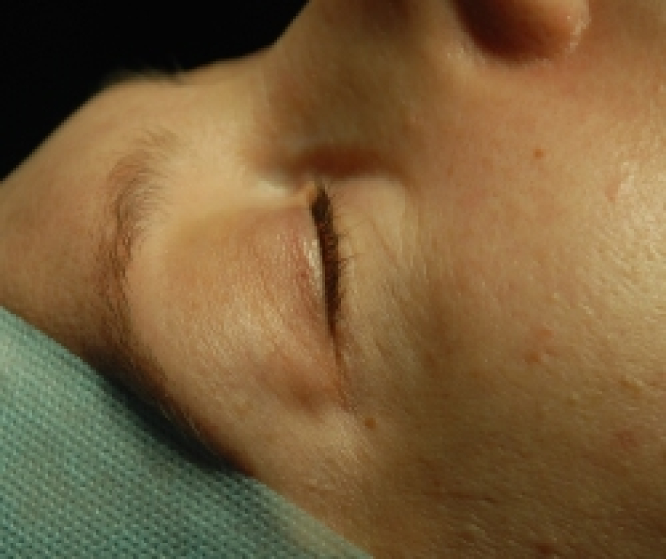 Пациентка на операционном столе