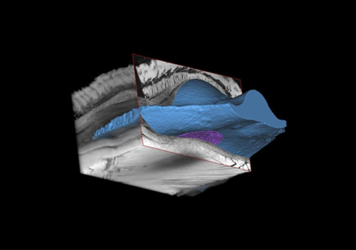 Робот поможет грудным имплантам адаптироваться к телу