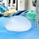 Как правильно выбрать тип грудного импланта?