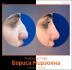 Борис Мирзоян. Фото до и после ринопластики