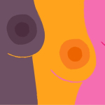 Разворот воронки: исправляем втянутые соски