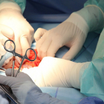 Россиянин скончался после пластической операции