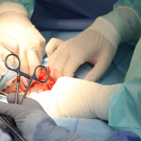 Россиянин скончался после пластической операции