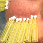 Мезонити: редкие факты, важные моменты