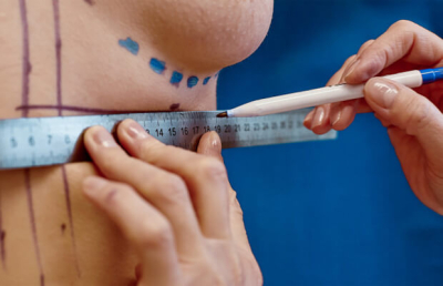 Увеличение груди и капсульная контрактура