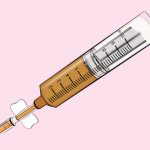 Липофилинг