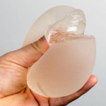 Шар или капля: выбираем грудные импланты