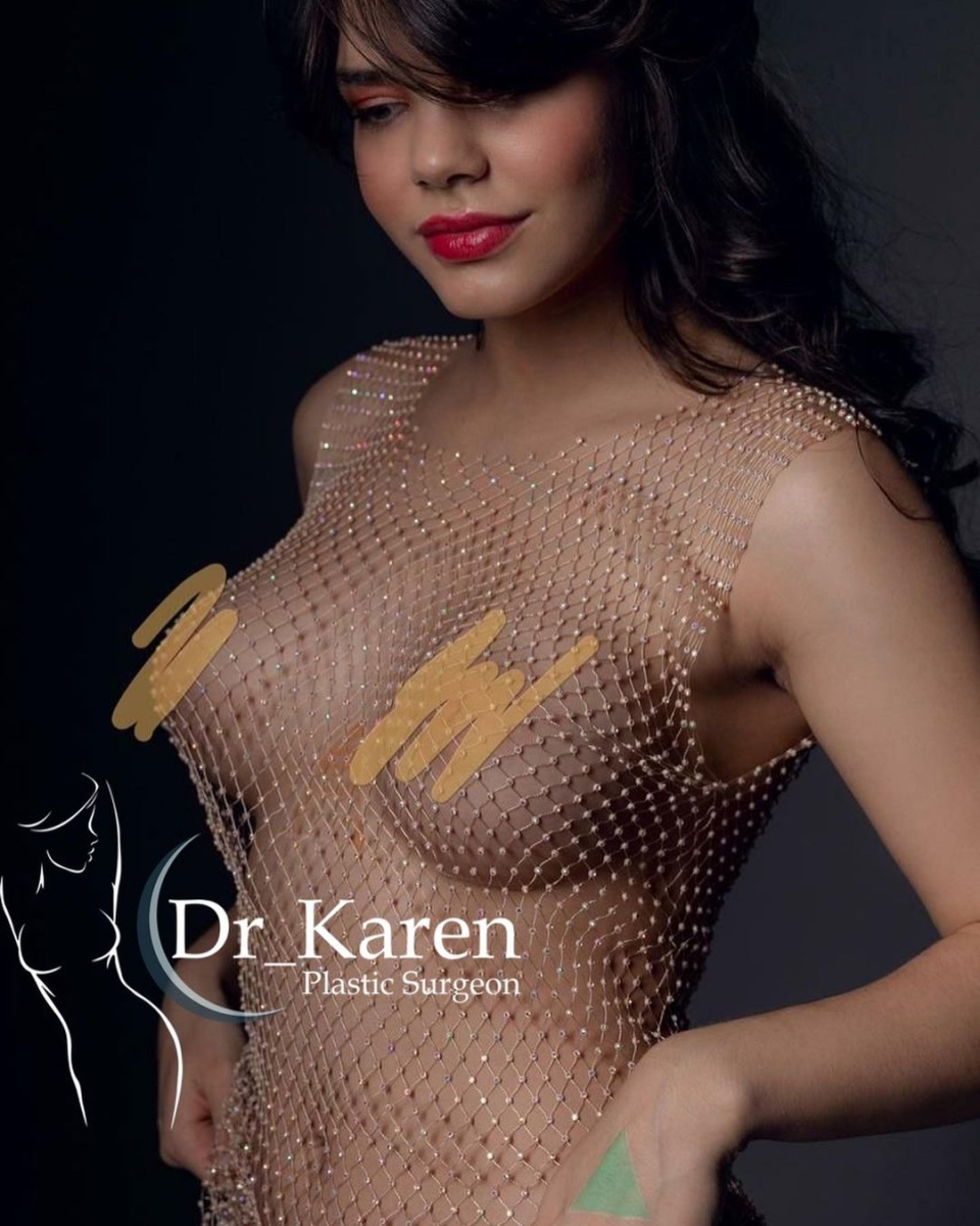 увеличение груди Карен Пайтян