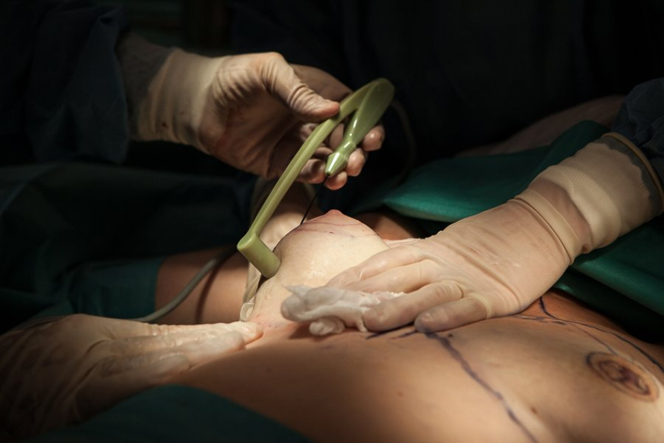 «Брест Тайт» подтяжка кожи