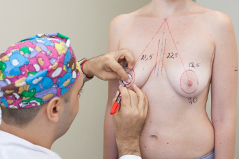 подтяжка груди Вардан Аршакян