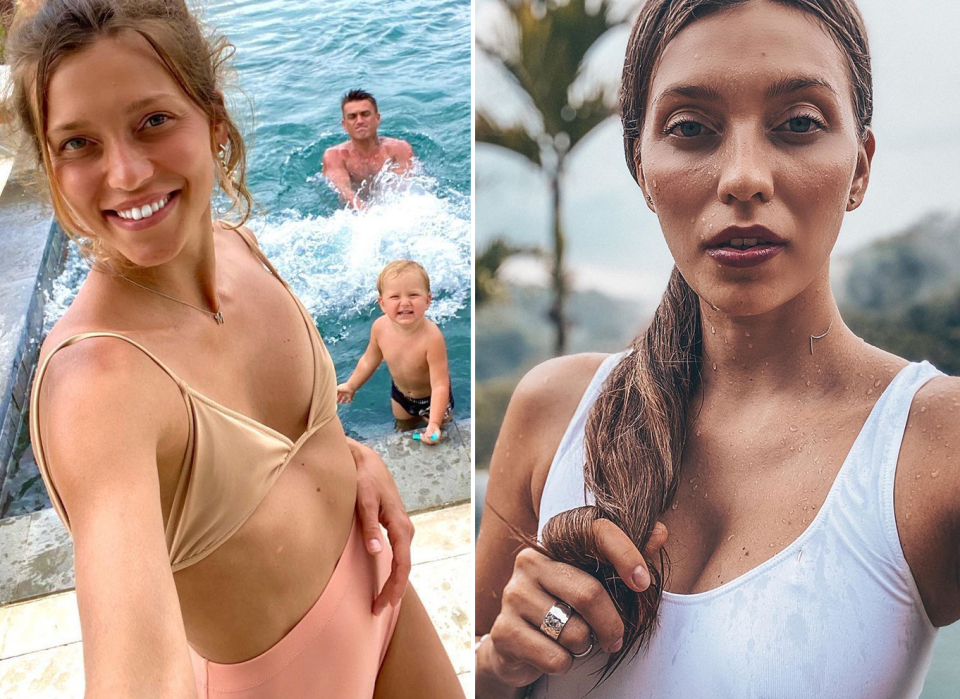 увеличение груди Регина Тодоренко