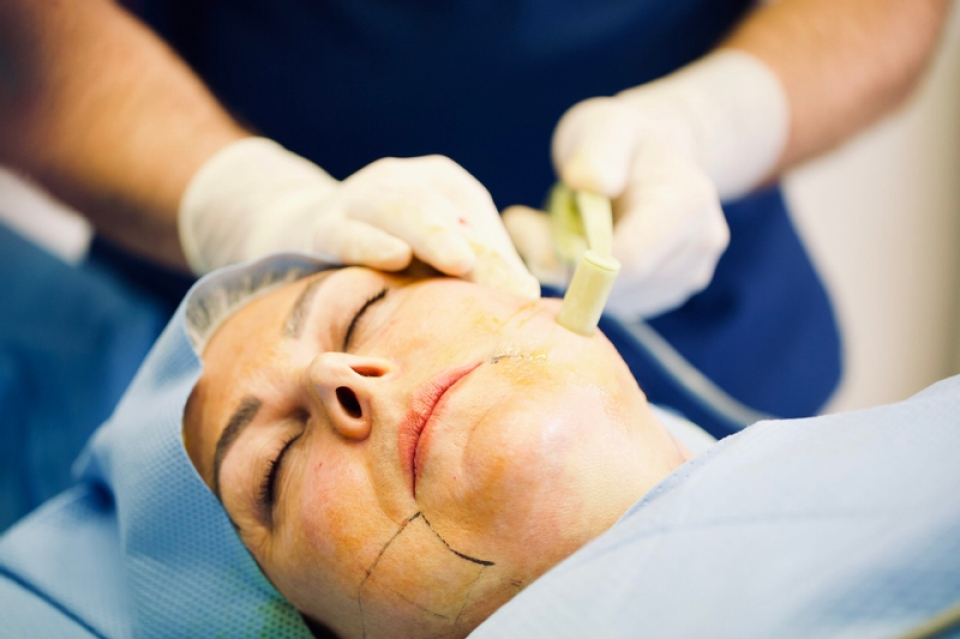 Как работает радиочастотное скульптурирование лица FaceTite?