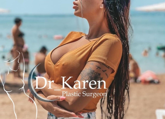 Пациентка пластического хирурга Карена Пайтяна после увеличения груди