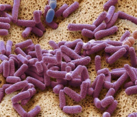 Пастерелла мультоцида