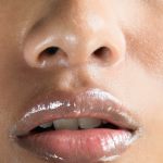 10 признаков хорошо выполненной ринопластики