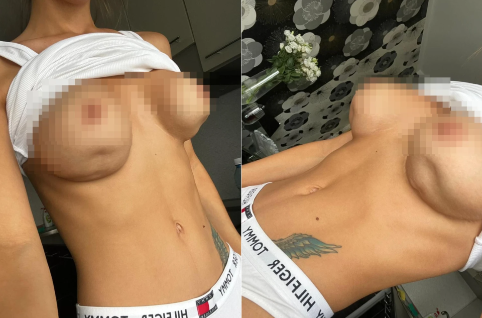 На неудачную пластику женщина потратила 400 000 рублей