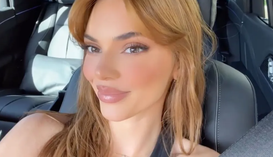 Губы Кендалл Дженнер привлекли внимание публики