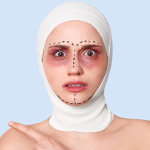 Изменение цвета кожи после подтяжки лица