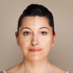 Правда о поддельных фото до и после пластической операции