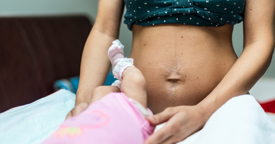 Подумайте о пластической хирургии