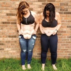 Пластические операции по удалению кожи после похудения