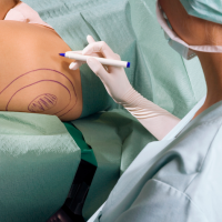 Названы самые популярные пластические операции в мире