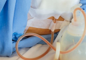 Дренаж после липосакции