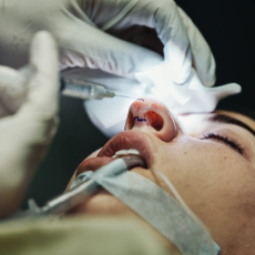 Окончательный результат ринопластики: сроки и особенности реабилитации