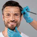 Растущий тренд на пластические операции для мужчин