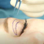 Всё на твоих глазах: от космецевтики до блефаропластики