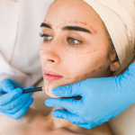 Спейслифтинг после косметологических процедур – да или нет