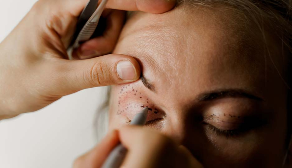 Углубленный взгляд на пластику век и чего ожидать