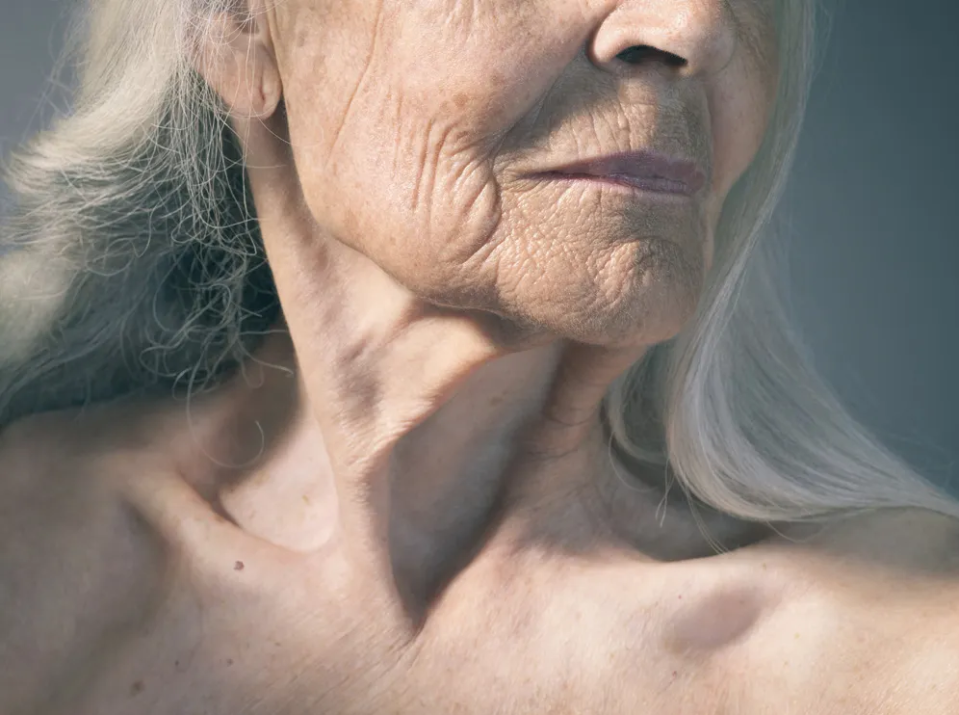 Подтяжка шеи или Ботокс: что работает лучше?