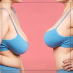 7 признаков того, что вы готовы к подтяжке груди