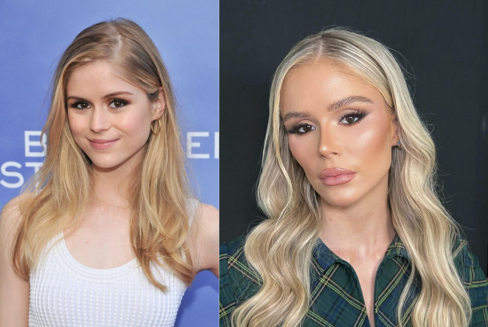 Эрин Мориарти до и после изменений внешности и предполагаемых пластических операций