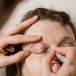 Популярность блефаропластики растёт