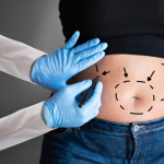 Посольство Китая предостерегает от пластических операций в Корее