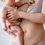 Возвращаем красивую фигуру после родов в операционной