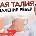 узкая талия операция